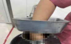 Nữ nhân viên nấu ăn ở trường học bị bàn tay phải cuốn vào máy xay thịt