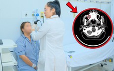 Đau đầu, chảy nước mũi suốt nhiều tháng, cô gái 24 tuổi sốc nặng khi đi khám