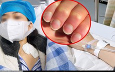 Nữ quản lý 40 tuổi bàng hoàng phát hiện suy thận giai đoạn cuối