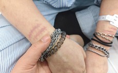 Khi con tự làm đau bản thân: Cha mẹ cần làm gì?