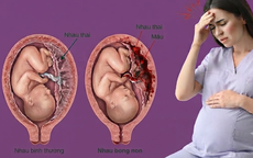 Nhau bong non nguy hiểm như thế nào?