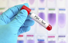 Mách bạn 7 cách tự nhiên giúp cân bằng nội tiết tố hiệu quả