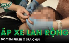 Tiêm filler ở spa chui, cô gái trẻ nhập viện vì áp xe lan rộng 