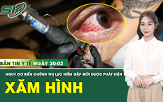 Bản tin Y tế 20/2: Hàng chục người mắc biến chứng thị lực hiếm gặp sau xăm hình