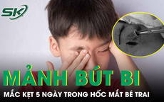 Gắp đoạn bút bi nhựa mắc kẹt 5 ngày trong hốc mắt bé trai