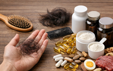 7 loại thực phẩm chức năng hỗ trợ mọc tóc, hiệu quả đến đâu?