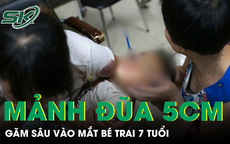 Gắp mảnh đũa gãy dài 5cm trong mắt bé trai 7 tuổi 