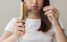 Sai lầm trong chăm sóc khiến rụng tóc nhiều người không nhận ra