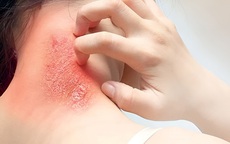 Nguy cơ nhiễm trùng máu có thể xảy ra từ các vết thương nhỏ