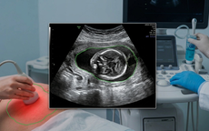 Nước ối ít và biến chứng thai kỳ: 'Cảnh báo đỏ' mẹ bầu cần lưu tâm