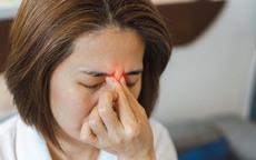 Viêm xoang vì sao dễ tái phát, có thể chữa dứt điểm hay không?