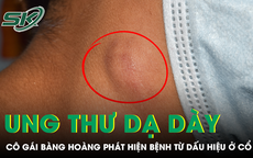 Cô gái 20 tuổi bàng hoàng phát hiện mắc ung thư dạ dày di căn toàn thân từ dấu hiệu ở cổ