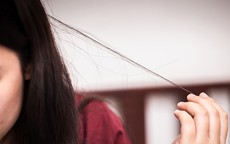 Tật giật, nhổ tóc gây tổn thương da đầu và sức khoẻ tinh thần như thế nào?