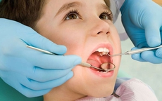 Trẻ sâu răng khi nào cần điều trị gây mê?