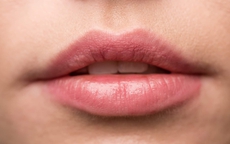 3 bí quyết trị thâm và khôi phục sắc môi hồng tự nhiên