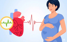 Thai kỳ ảnh hưởng đến tim mạch như thế nào?