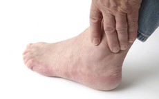 Sai lầm thường gặp chấn thương phần mềm cổ chân