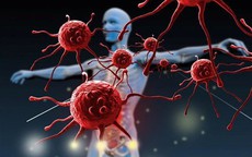 Những bộ phận nào trên cơ thể thường gây ung thư và cách phòng tránh hiệu quả