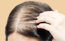 5 thói quen gây hại khiến tóc ngày càng mỏng đi