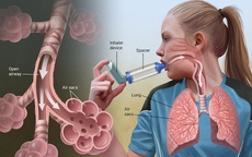 Triệu chứng thường gặp và các mức độ khó thở ở hen suyễn