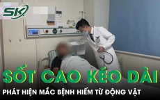 Sốt cao kéo dài không dứt, người đàn ông phát hiện mắc bệnh hiếm từ động vật