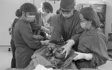 Người phụ nữ chịu đau âm ỉ vùng bụng suốt 6 tháng, đến viện, bác sĩ 'lấy ra' khối u sarcoma tử cung gần 9kg