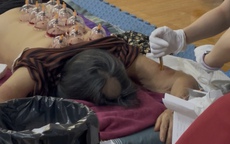 Mục sở thị cơ sở chữa bách bệnh bằng... 'giác hơi hút máu' ở Hà Nội