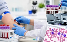 Những xét nghiệm cơ bản ai cũng nên làm