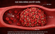 2 cách đơn giản ngăn ngừa cục máu đông