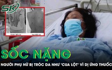 Tự ý dùng thuốc, người phụ nữ sốc nặng khi da bị tróc như 'cua lột' 