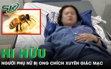 Ong chích xuyên giác mạc, người phụ nữ sưng phù mắt phải cấp cứu khẩn