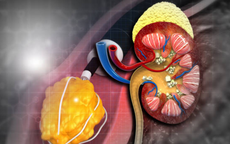 Phát hiện loại thuốc mới đầy hứa hẹn trị bệnh thận hiếm nguy hiểm