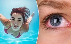 Cách bảo vệ mắt khi đi bơi