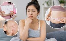 Dấu hiệu buồng trứng đa nang dễ bị bỏ qua