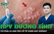 Có phải HPV dương tính là bị ung thư cổ tử cung không?