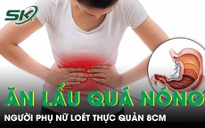 Người phụ nữ loét thực quản 8cm vì thói quen ăn lẩu quá nóng 