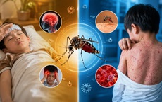 Đừng xem nhẹ những cơn sốt mùa hè