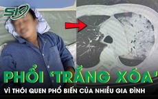 Tưởng cảm cúm, người đàn ông bất ngờ suy đa tạng, phổi ‘trắng xoá’ vì thói quen nhiều người mắc