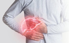 Chủ quan khi mắc xơ gan, nhiều biến chứng đe dọa tính mạng
