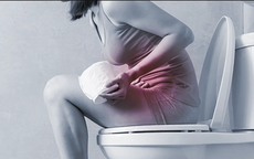 Vì sao phụ nữ mãn kinh dễ bị táo bón?