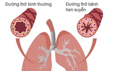 Khi nào người bệnh hen cần đến viện ngay lập tức?