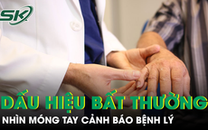 6 dấu hiệu bất thường ở móng tay có thể cảnh báo bệnh lý nguy hiểm 