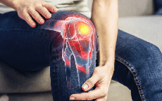Người bị thoái hóa khớp gối nên kiêng gì?