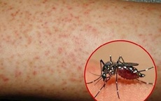 Hơn 1.100 ca mắc sốt xuất huyết, Lâm Đồng kích hoạt các biện pháp phòng, chống dịch