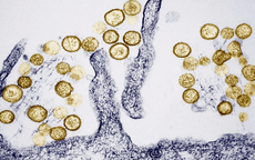 WHO đánh giá nguy cơ lây lan virus Hanta trong cộng đồng ở ‘mức thấp’