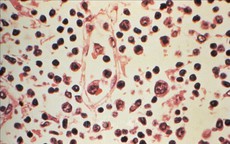 Đài Loan (Trung Quốc) ghi nhận 1 ca tử vong do nhiễm virus Hanta