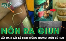 Bé trai 3 tuổi nôn ra giun, bác sĩ phẫu thuật lấy ra 3 bát ký sinh trùng trong ruột 