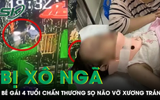 Bé gái 4 tuổi bị bạn xô ngã từ cầu trượt cao 1,5m chấn thương sọ não vỡ xương trán
