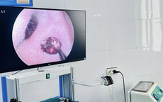 Đau nhức tai suốt một tuần, người phụ nữ tá hỏa vì 'vị khách lạ' trong tai