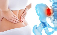 Đau vùng chậu mạn tính do đâu?